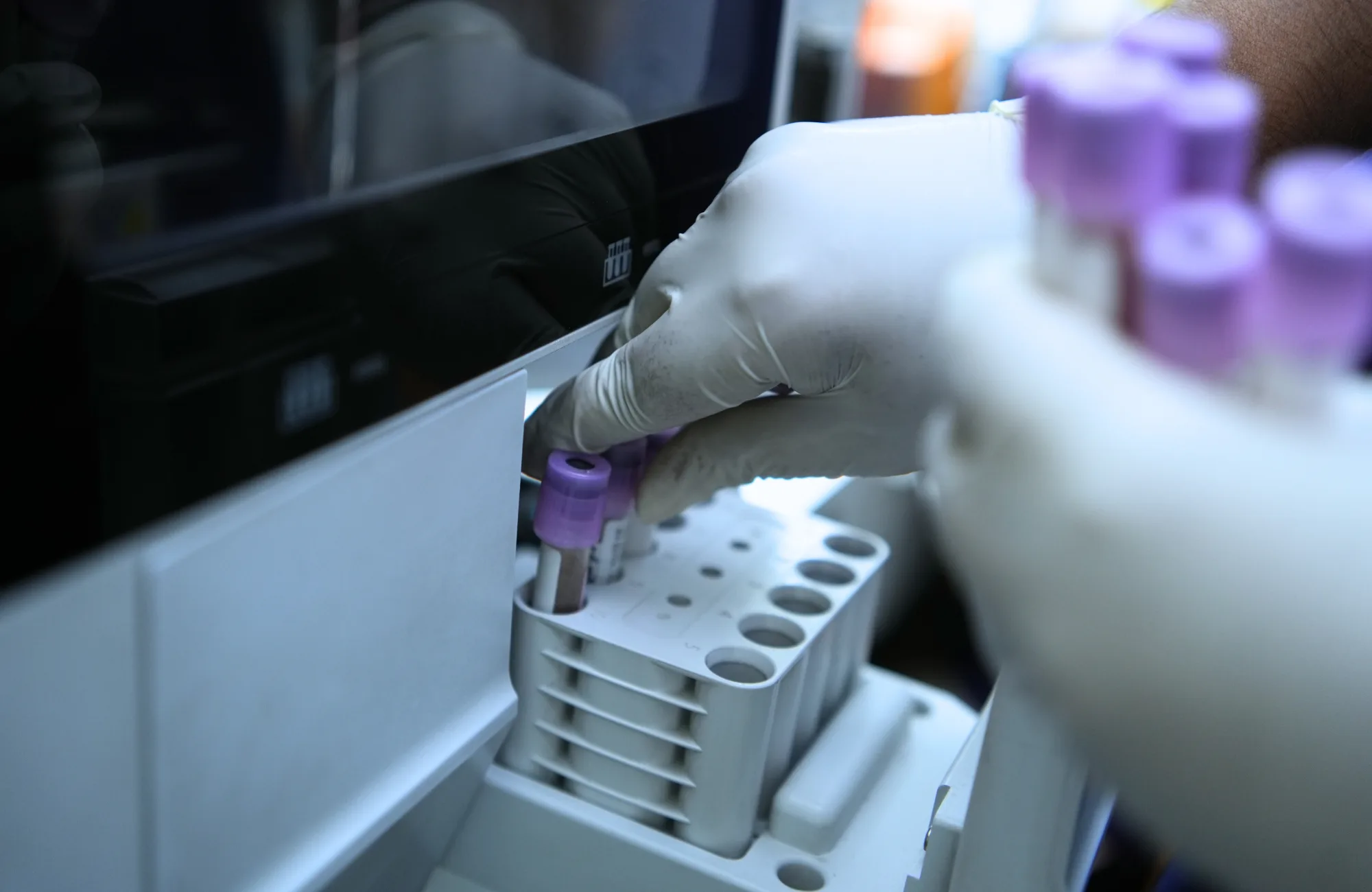 ucbxrengz8zlt9m7wv6i